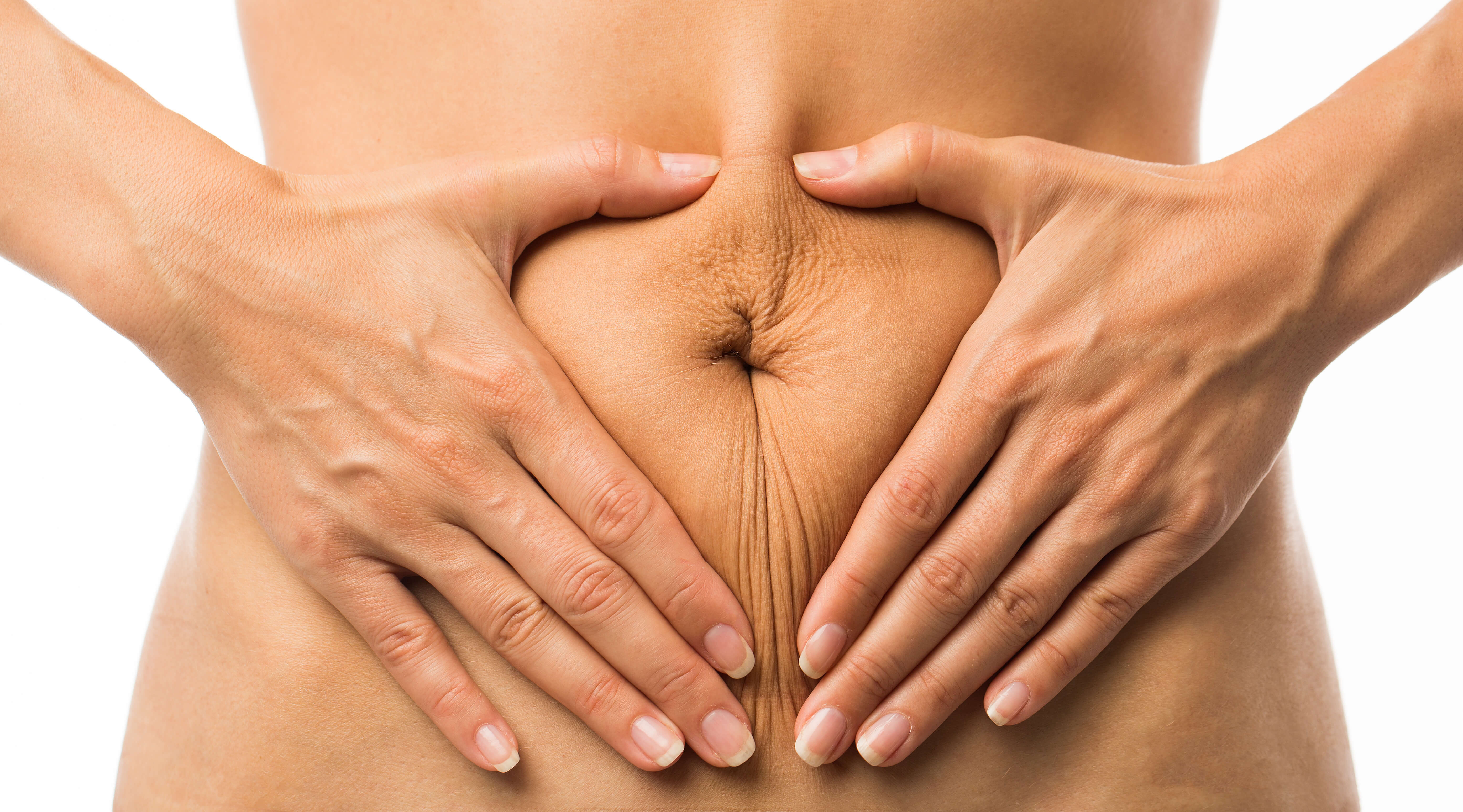 felesleges bőr a hason 