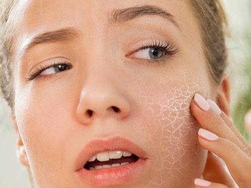 Hogyan ápoljuk a száraz bőrt? Vitaminok és kiegészítők száraz bőrre