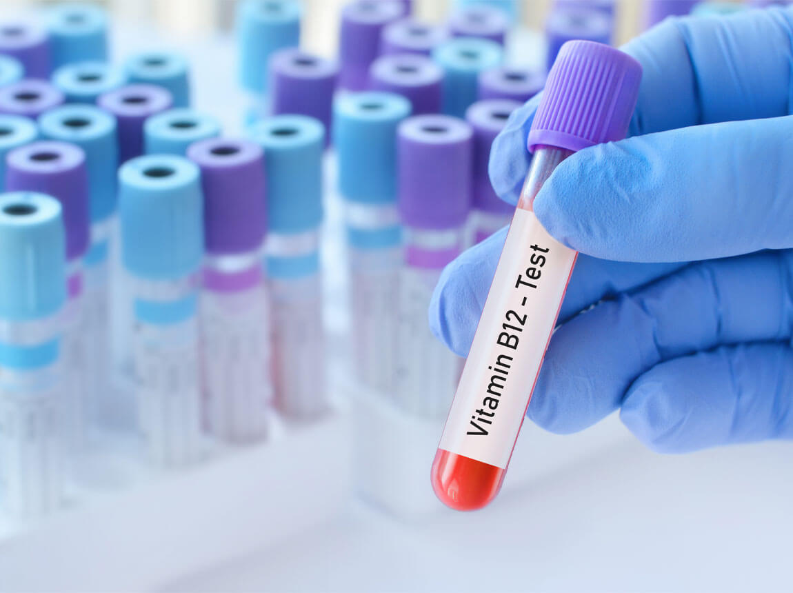 A B12-vitamin